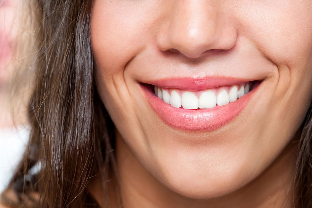 Veneers vs. Bonding: Which Is Better for Your Smile